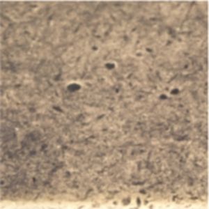 Uchwyt meblowy UP11 G35